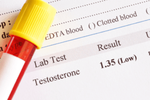 Abnormal low testosterone hormone test result with blood sample tube
