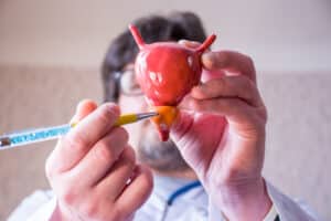 A doctor pointing to a model of the prostate